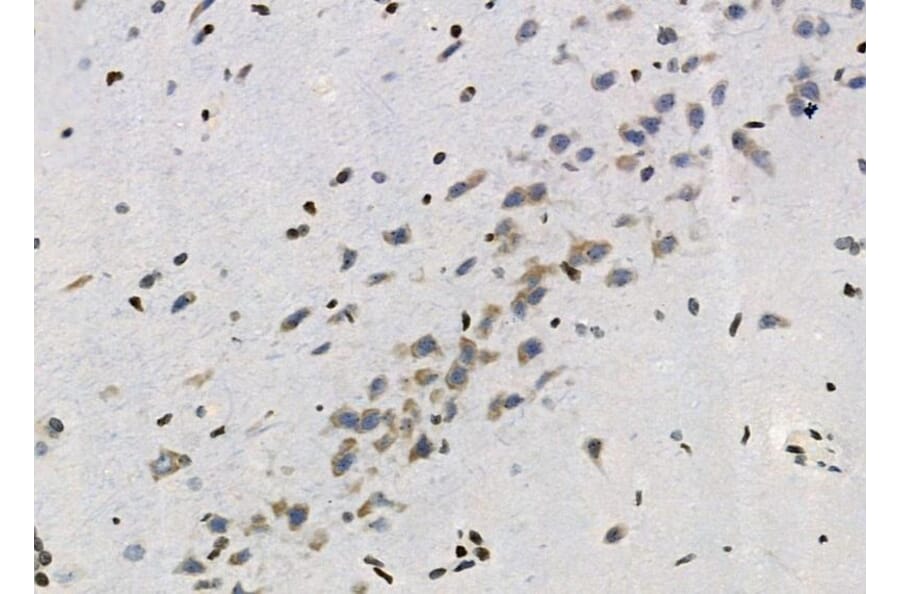 Validation Data - Anti-ASC2 Antibody (A267464)