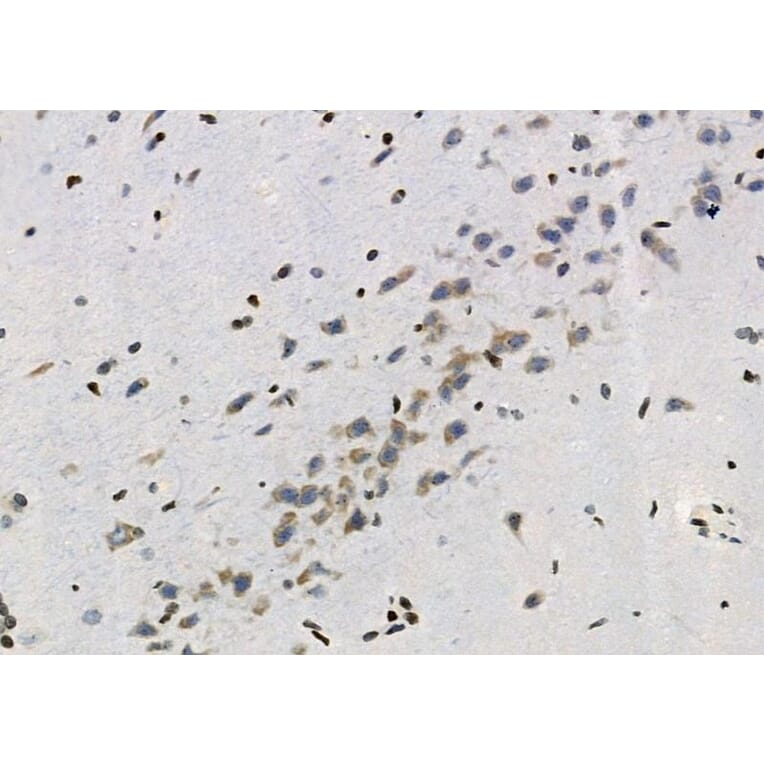 Validation Data - Anti-ASC2 Antibody (A267464)