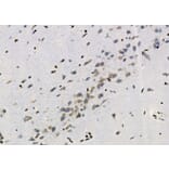 Validation Data - Anti-ASC2 Antibody (A267464)