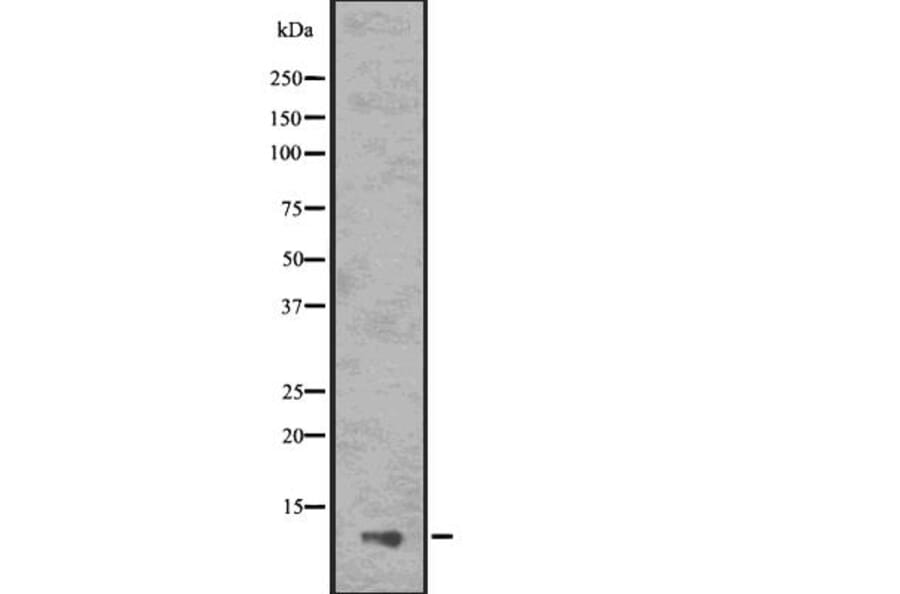 Validation Data - Anti-ASC2 Antibody (A267464)