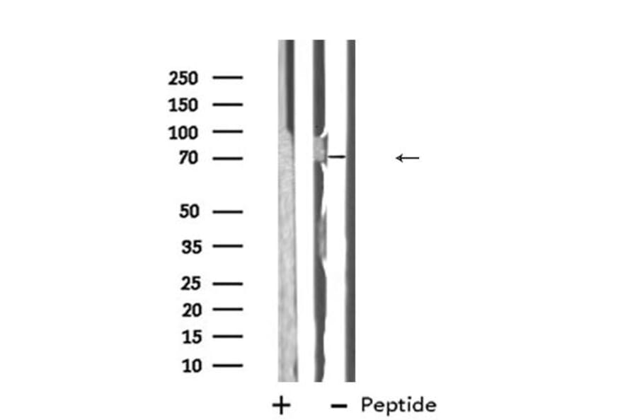 Validation Data - Anti-ABCG5 Antibody (A268081)