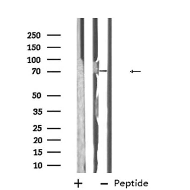 Validation Data - Anti-ABCG5 Antibody (A268081)