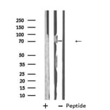 Validation Data - Anti-ABCG5 Antibody (A268081)