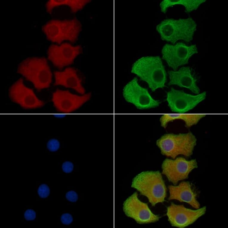 Validation Data - Anti-ABCG5 Antibody (A268081)