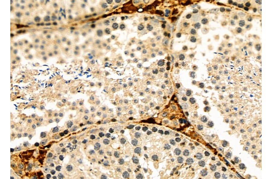 Validation Data - Anti-HIF-3 alpha Antibody (A268189)