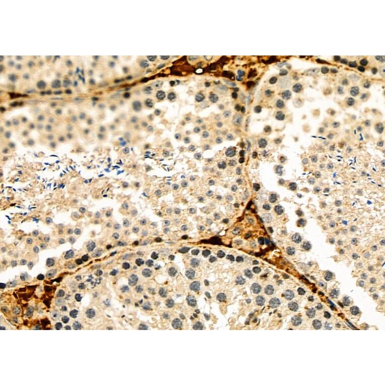Validation Data - Anti-HIF-3 alpha Antibody (A268189)