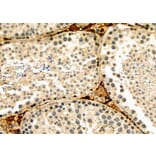 Validation Data - Anti-HIF-3 alpha Antibody (A268189)