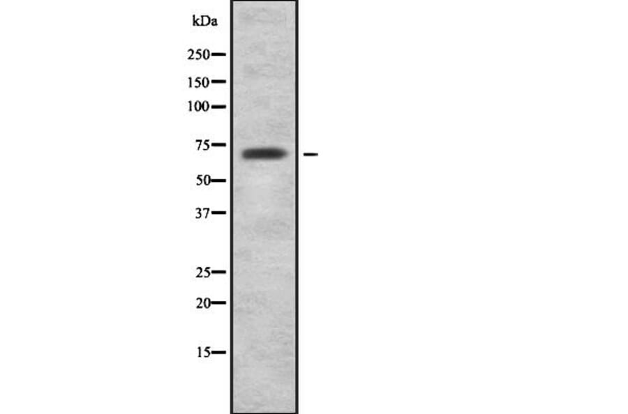Validation Data - Anti-HIF-3 alpha Antibody (A268189)