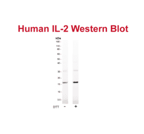WB - Anti-IL-2 Antibody [MT2A91] (Biotin) (A269704) - Antibodies.com