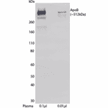 WB - Anti-Apolipoprotein B Antibody [LDL 11] (Biotin) (A269780) - Antibodies.com