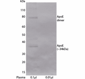 WB - Anti-Apolipoprotein E Antibody [E981] (A269843) - Antibodies.com