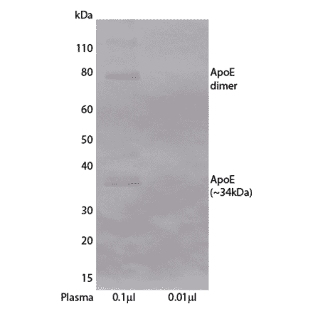 WB - Anti-Apolipoprotein E Antibody [E981] (A269843) - Antibodies.com