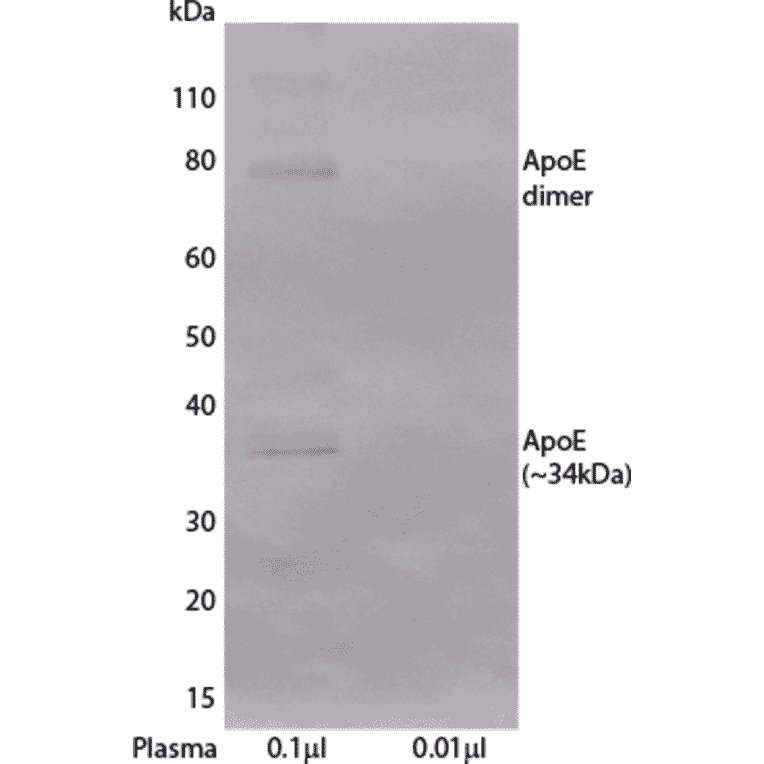 WB - Anti-Apolipoprotein E Antibody [E981] (A269843) - Antibodies.com