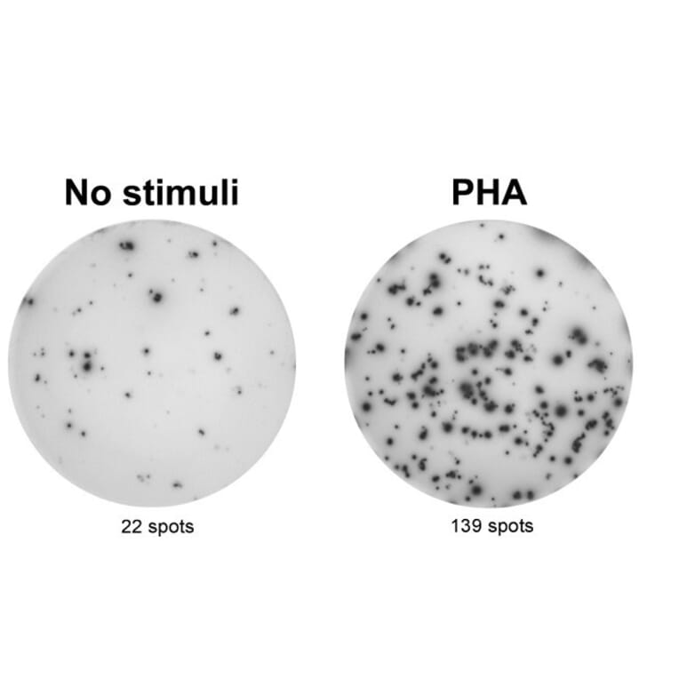 ELISpot - Anti-IL-17A Antibody [MT49A7] (A269864) - Antibodies.com