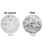 ELISpot - Anti-IL-17A Antibody [MT49A7] (A269864) - Antibodies.com