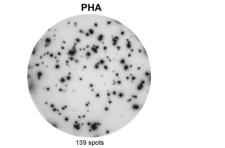 ELISpot - Anti-IL-17A Antibody [MT49A7] (A269864) - Antibodies.com