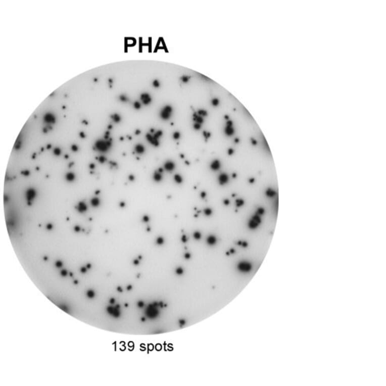 ELISpot - Anti-IL-17A Antibody [MT49A7] (A269864) - Antibodies.com