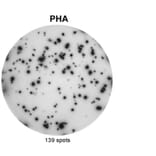 ELISpot - Anti-IL-17A Antibody [MT49A7] (A269864) - Antibodies.com