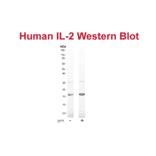 WB - Anti-IL-2 Antibody [MT2A91] (A269867) - Antibodies.com