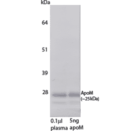 WB - Anti-Apo-M Antibody [M5] (A269924) - Antibodies.com