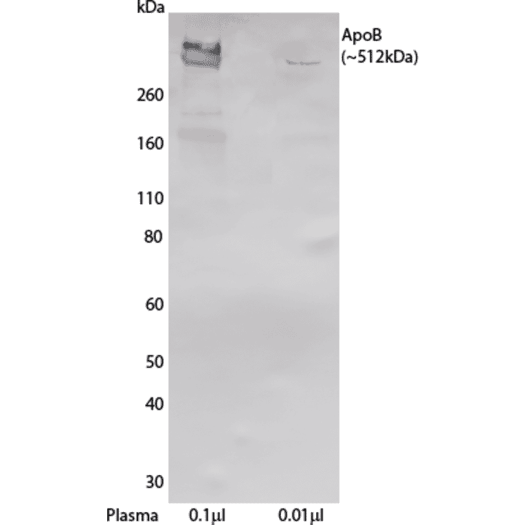 WB - Anti-Apolipoprotein B Antibody [LDL 20 + LDL 17] (A269947) - Antibodies.com