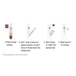 Test Procedure - Anti-SARS-CoV-2 Neutralization Antibody Test Kit (Colloidal Gold) (CP04010-25) - Antibodies.com