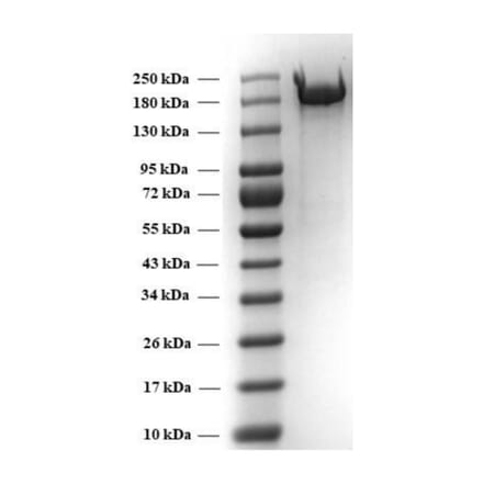 SDA-PAGE - Recombinant SARS-CoV-2 Spike Protein (B.1.351 Variant) (Functional) (A269990) - Antibodies.com