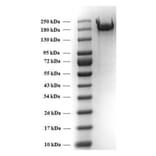 SDA-PAGE - Recombinant SARS-CoV-2 Spike Protein (B.1.351 Variant) (Functional) (A269990) - Antibodies.com
