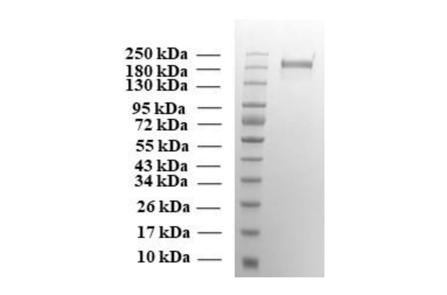 SDA-PAGE - Recombinant SARS-CoV-2 Spike Protein (P.1. Variant) (Functional) (A269991) - Antibodies.com