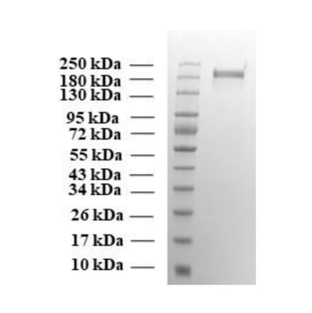 SDA-PAGE - Recombinant SARS-CoV-2 Spike Protein (P.1. Variant) (Functional) (A269991) - Antibodies.com
