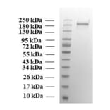 SDA-PAGE - Recombinant SARS-CoV-2 Spike Protein (P.1. Variant) (Functional) (A269991) - Antibodies.com