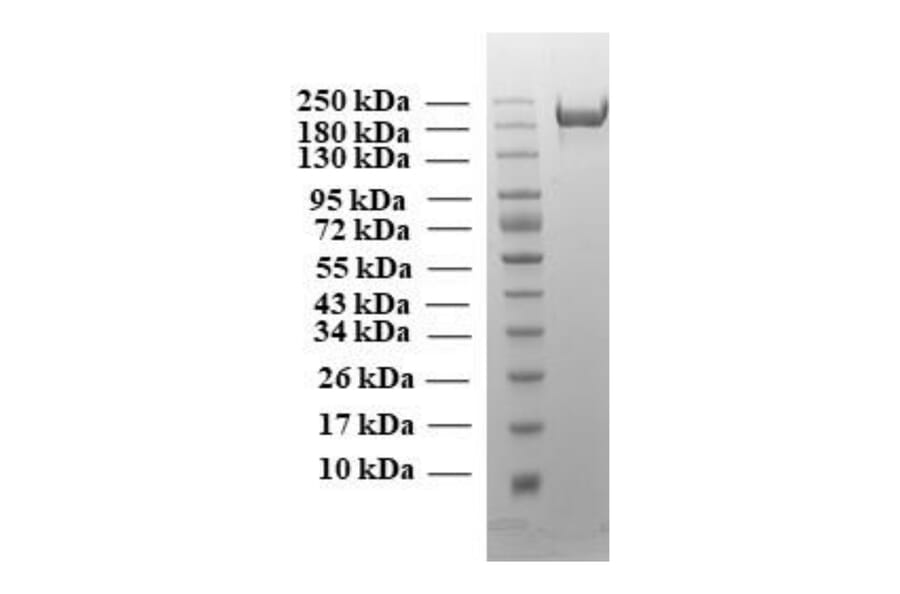 SDA-PAGE - Recombinant SARS-CoV-2 Spike Protein (B1.617 Variant) (Functional) (A269992) - Antibodies.com