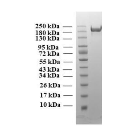 SDA-PAGE - Recombinant SARS-CoV-2 Spike Protein (B1.617 Variant) (Functional) (A269992) - Antibodies.com