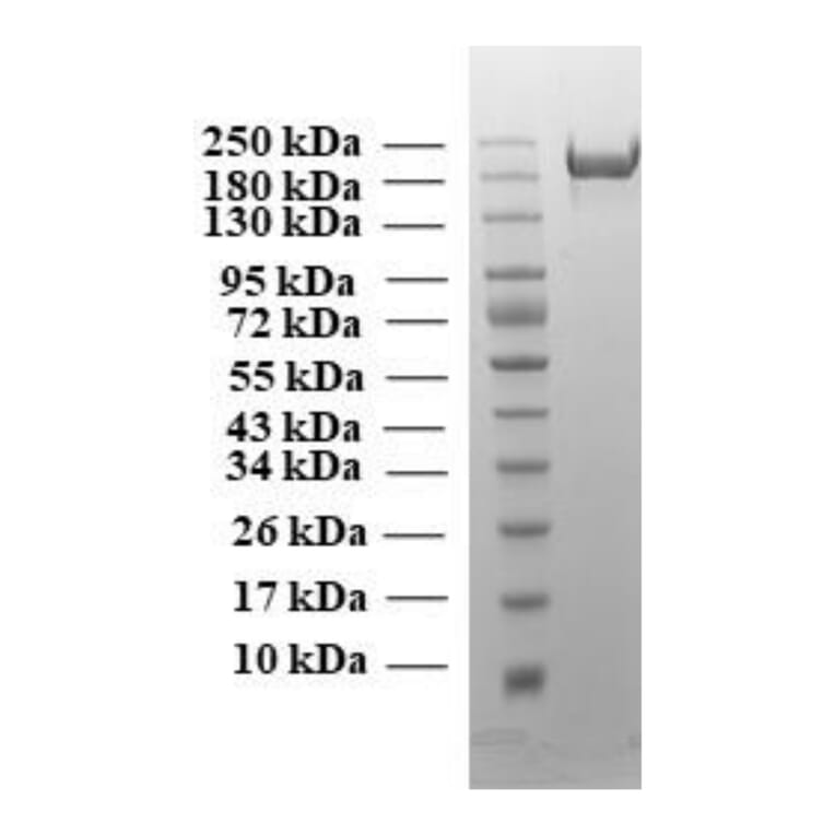 SDA-PAGE - Recombinant SARS-CoV-2 Spike Protein (B1.617 Variant) (Functional) (A269992) - Antibodies.com