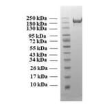 SDA-PAGE - Recombinant SARS-CoV-2 Spike Protein (B1.617 Variant) (Functional) (A269992) - Antibodies.com