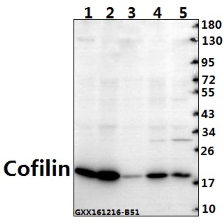 Anti-Cofilin (M1) Antibody from Bioworld Technology (BS3579) - Antibodies.com