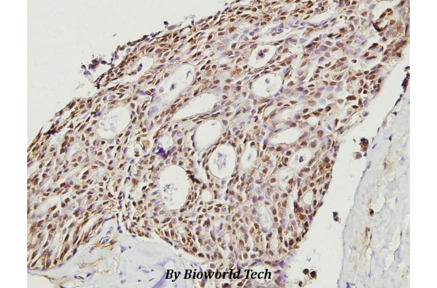 Anti-Cofilin (M1) Antibody from Bioworld Technology (BS3579) - Antibodies.com