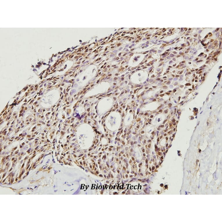 Anti-Cofilin (M1) Antibody from Bioworld Technology (BS3579) - Antibodies.com