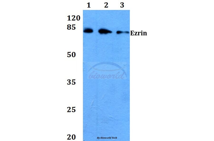 Anti-Ezrin (G560) Antibody from Bioworld Technology (BS3580) - Antibodies.com