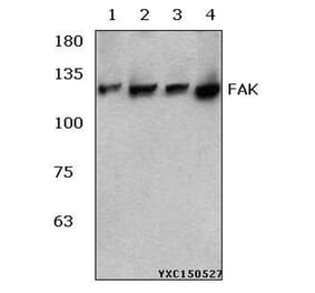 Anti-FAK (R919) Antibody from Bioworld Technology (BS3581) - Antibodies.com