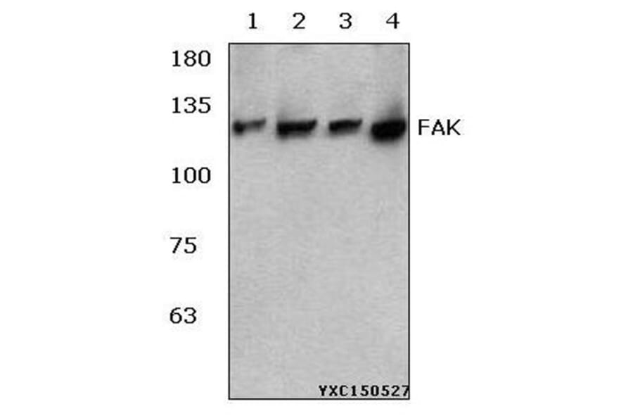 Anti-FAK (R919) Antibody from Bioworld Technology (BS3581) - Antibodies.com