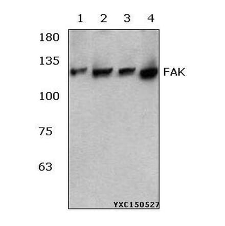 Anti-FAK (R919) Antibody from Bioworld Technology (BS3581) - Antibodies.com