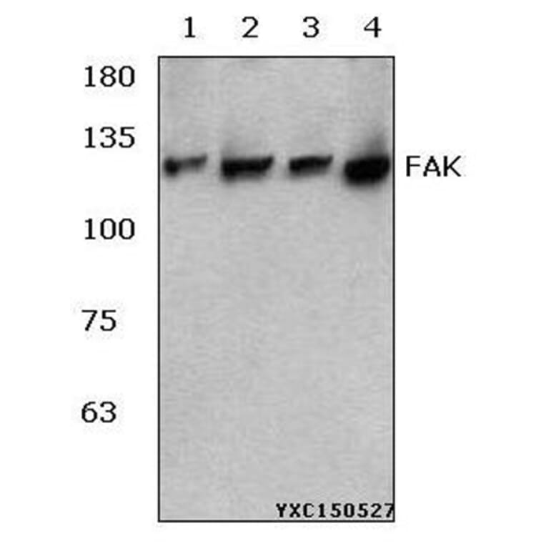 Anti-FAK (R919) Antibody from Bioworld Technology (BS3581) - Antibodies.com