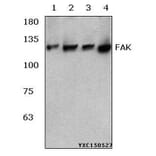 Anti-FAK (R919) Antibody from Bioworld Technology (BS3581) - Antibodies.com