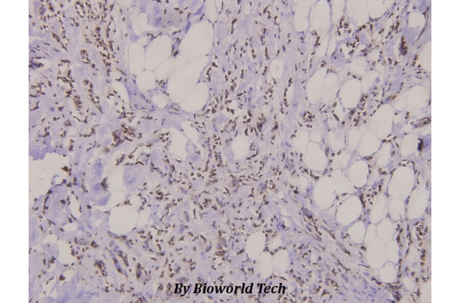 Anti-FAK (R919) Antibody from Bioworld Technology (BS3581) - Antibodies.com