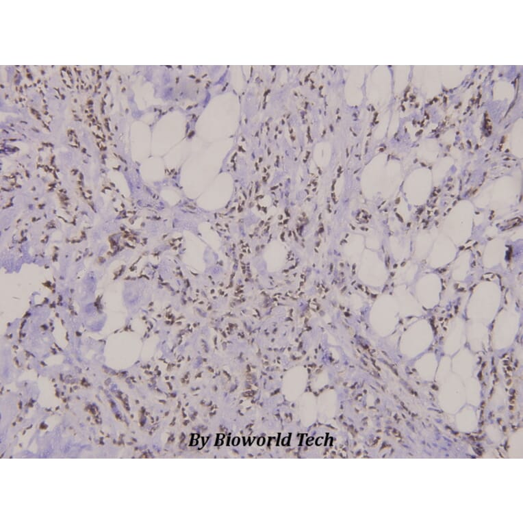 Anti-FAK (R919) Antibody from Bioworld Technology (BS3581) - Antibodies.com
