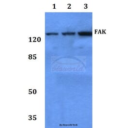 Anti-FAK (I855) Antibody from Bioworld Technology (BS3583) - Antibodies.com