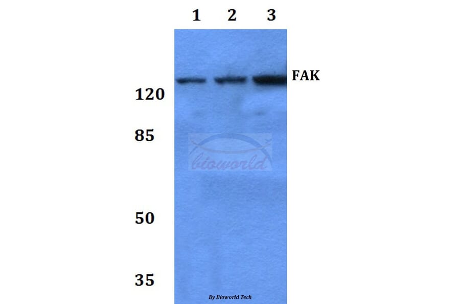 Anti-FAK (I855) Antibody from Bioworld Technology (BS3583) - Antibodies.com