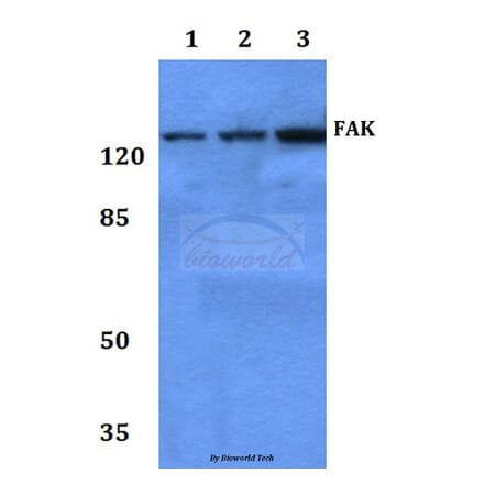 Anti-FAK (I855) Antibody from Bioworld Technology (BS3583) - Antibodies.com