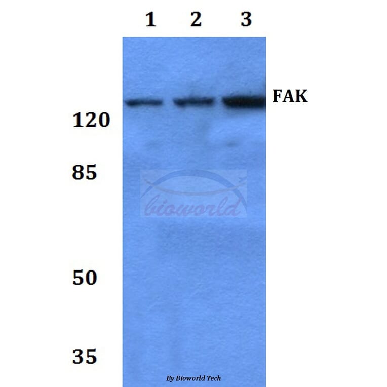 Anti-FAK (I855) Antibody from Bioworld Technology (BS3583) - Antibodies.com